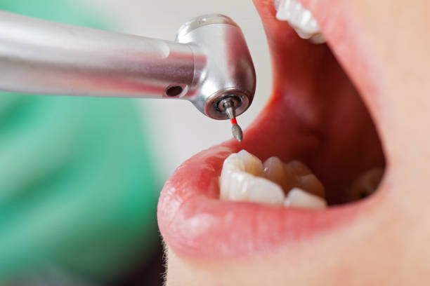 Best Emergency Treatment for Toothache in Kettering, MD